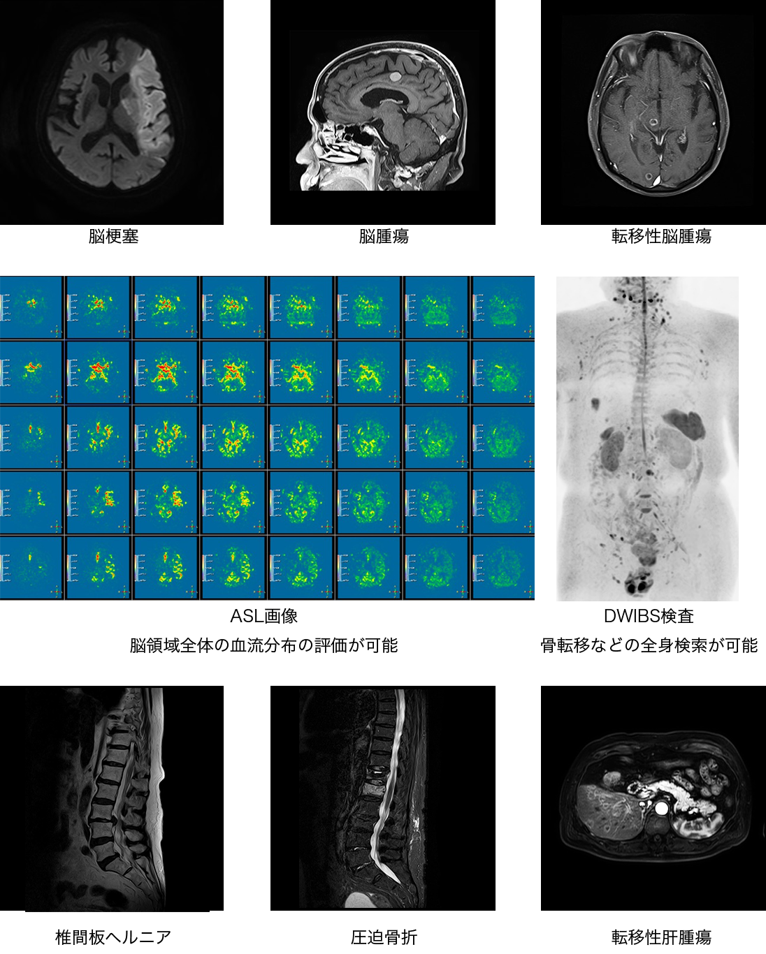 MRI画像の特徴