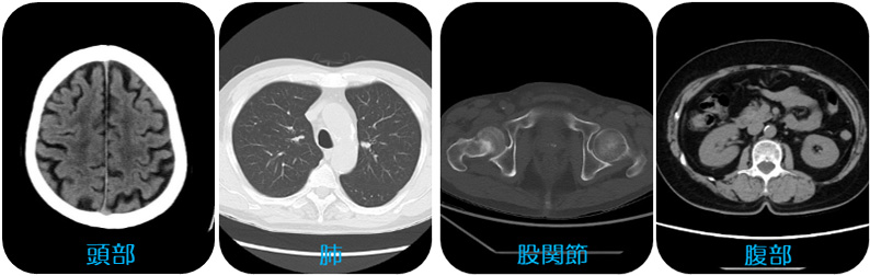 CT検査