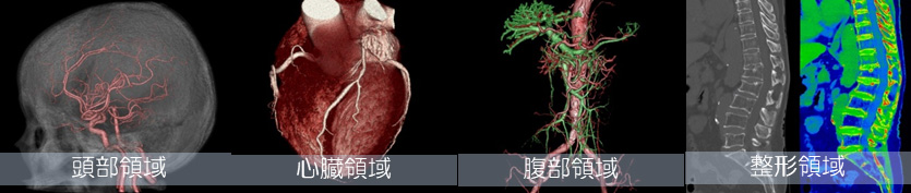 単純CT検査と造影CT検査